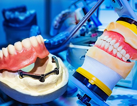 The denture creation process involves many steps