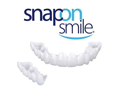 Snap on smile model