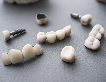 Implant supported crowns and bridges