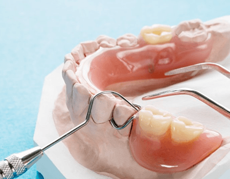 a model example of partial dentures in Willow Grove