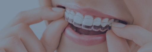 Invisalign coupon