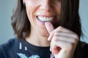 woman putting in Invisalign aligner	